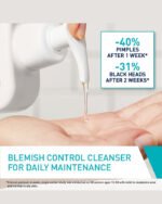 blemish control cleanser with salicyclic acid & ceramides mve delivery technology